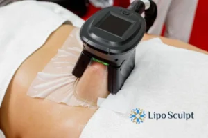 Cryolipolysis Helping You Getting that Perfect Summer Body 3 Cryolipolysis Eton can give you the best summer body - contact us today!